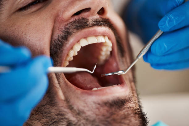 Best Weekend Emergency Dental Services in Rantoul, IL