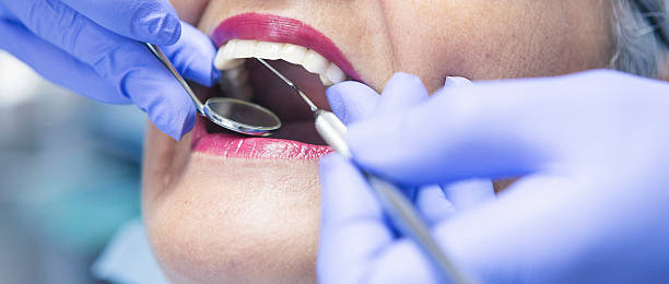 Best Emergency Treatment for Oral Infections in Rantoul, IL